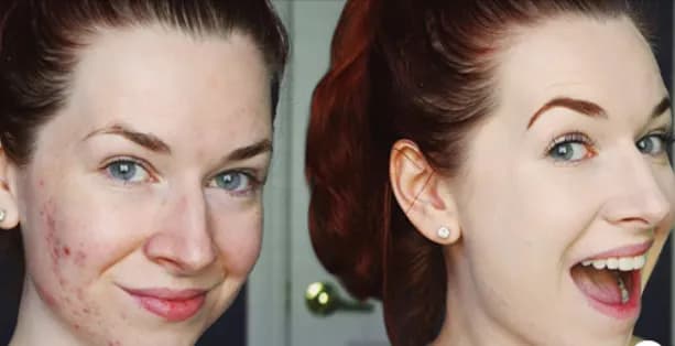 Miya serum rewitalizujące Hebe – poznaj sekrety pięknej skóry