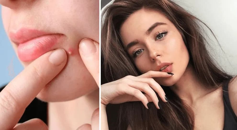 Skuteczne sposoby na pryszcze: jak szybko je wyleczyć i zapobiec