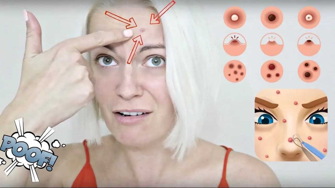 Jak pozbyć się bolącego podskórnego pryszcza w szybki sposób